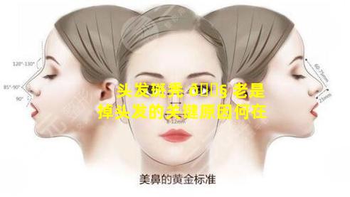 头发斑秃 🐧 老是掉头发的关键原因何在